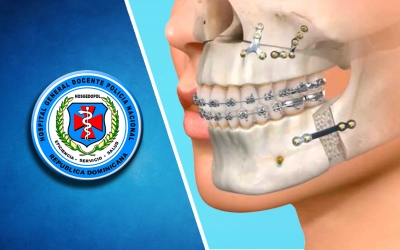 CIRUGÍA MAXILOFACIAL